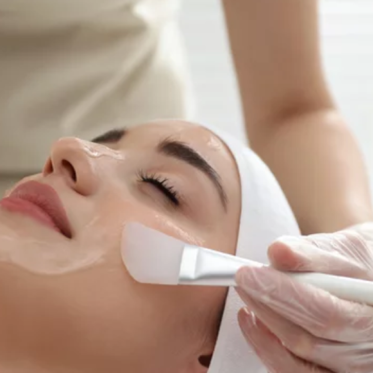 Chemical Face Peels