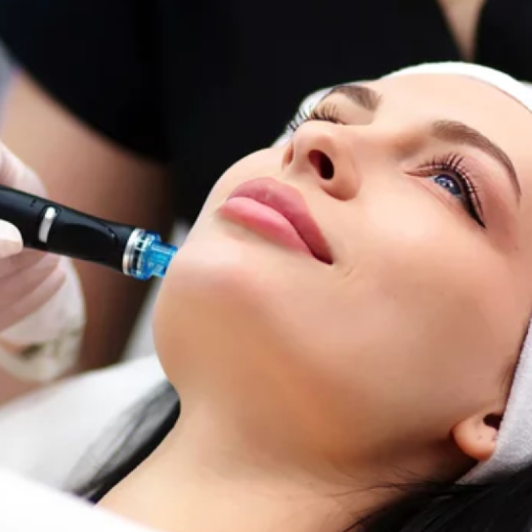 Hydro dermabrasion