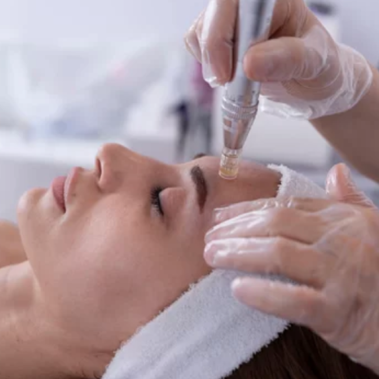 Micro needling