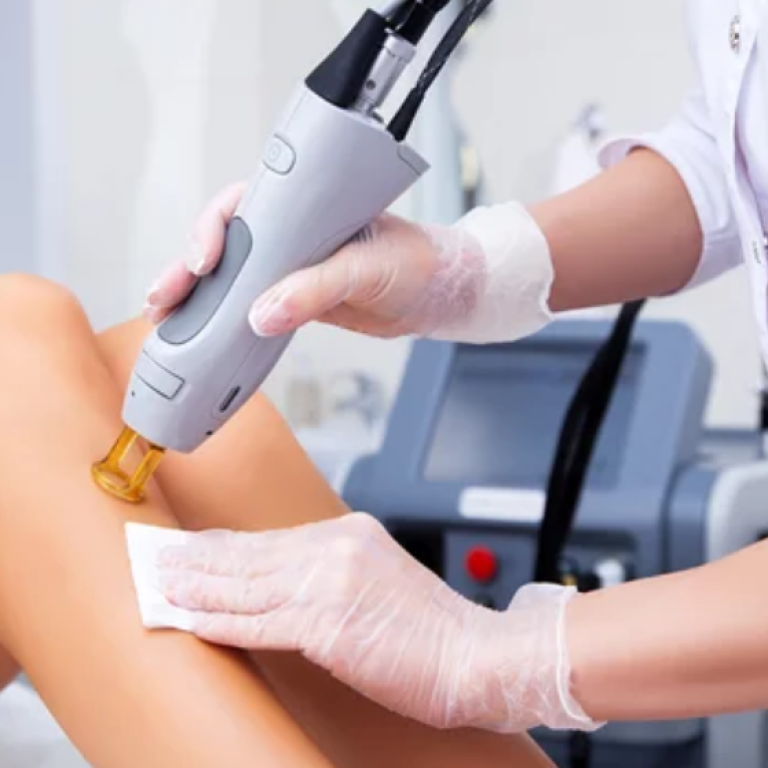 laser-hair-removal